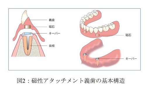 図1：下顎位，体位ののちがいによる呼吸量の変化　N-U: 咬頭嵌合位-アップライト N-S: 咬頭嵌合位-仰臥位 P-S: 下顎前方位-仰臥位