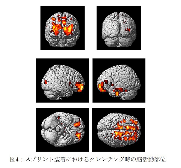 図4：スプリント装着におけるクレンチング時の脳活動部位